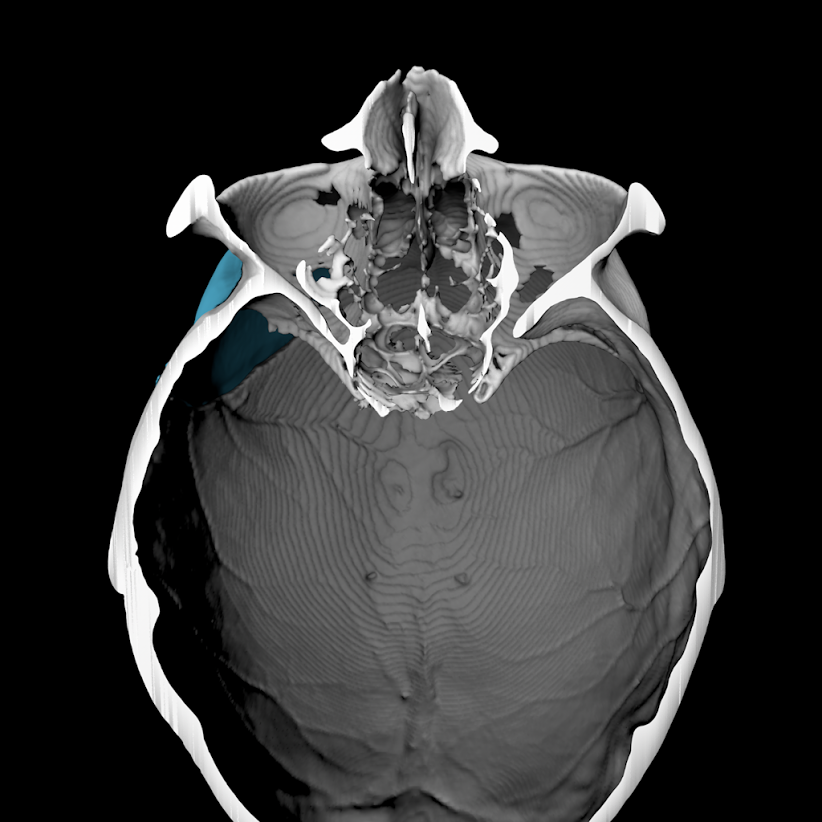 Clinical Visualization & Medical Imaging