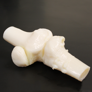 3D Printed Knee