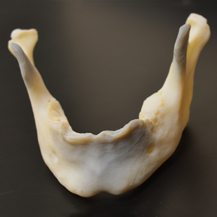 3D Printed Mandible