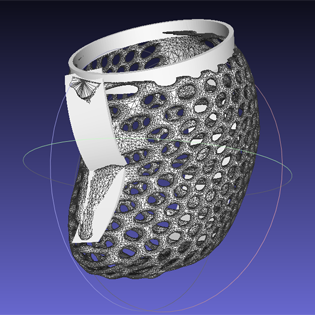 Custom Upper-Limb Fitting
