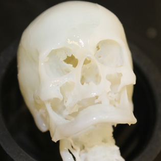 3D Skull